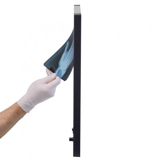 Негатоскоп Армед 1-кадровый 10